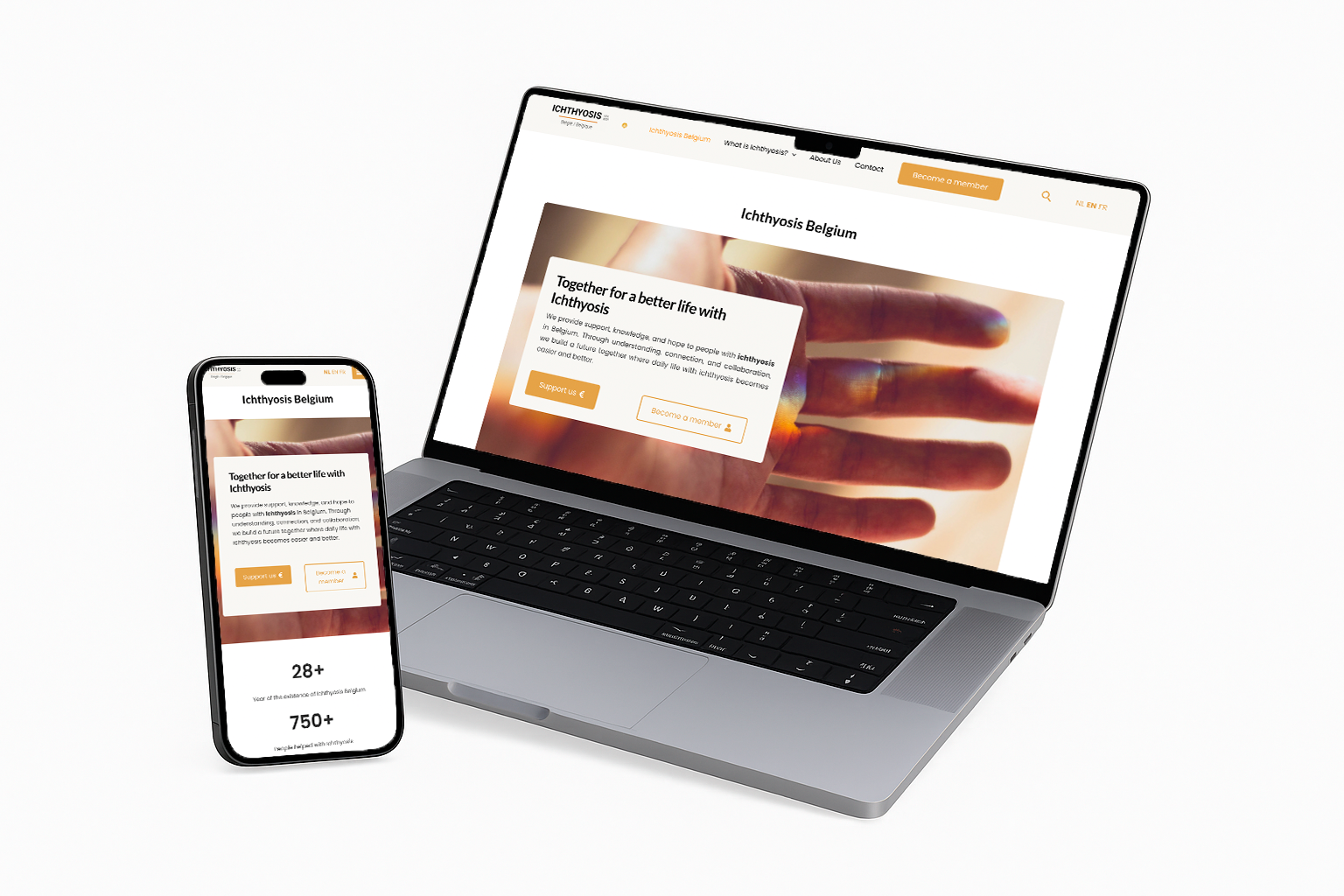 Ichthyosis België website mockup